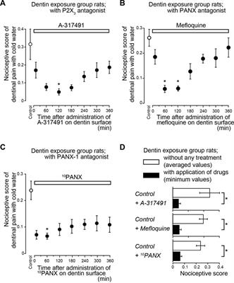 Piezo1-pannexin-1-P2X3 axis in odontoblasts and neurons mediates sensory transduction in dentinal sensitivity